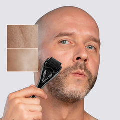 AEKONIK Derma Roller for Hair & Beard Care - 0.3 MM Scalp and Skin Massager - Grooming Tool for Oil Application Daily Handle Gentle